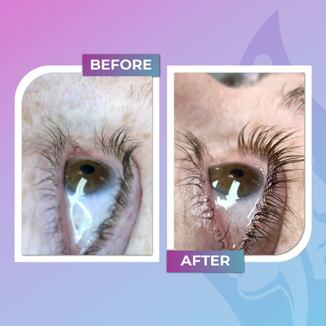 Before and after lash lift for fuller-looking lashes