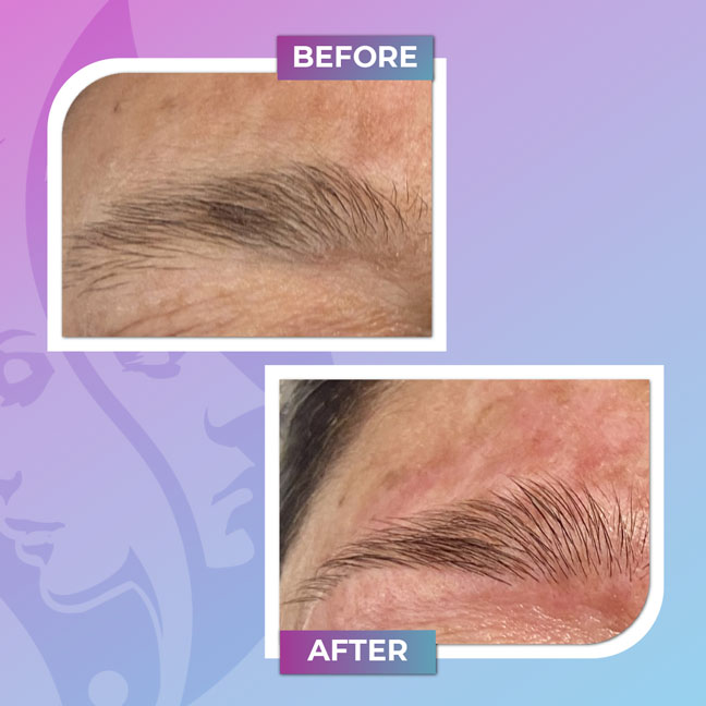 Before and after eyebrow shaping treatment